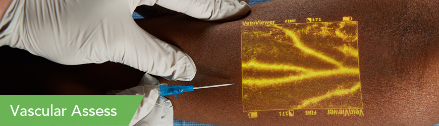 Christie Medical VeinViewer Vascular Assess