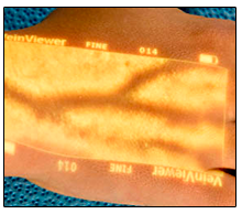 VienViewer 2 year old child's hand